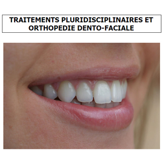 TRAITEMENTS PLURIDISCIPLINAIRES ET ORTHOPEDIE DENTO-FACIALE